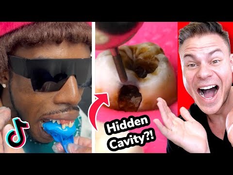 Amazing Tiktoks That Will Make You Want Braces!