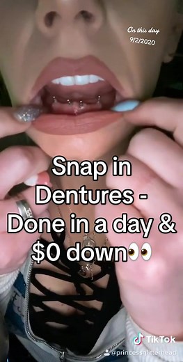 I was SO insecure about how i looked without my teeth until the world took me by surprise & embraced me anyway🥺 I share bc i KNOW how hard all of this is. Living w it. Finding ways to fix & afford it. Having to work & pay bills while not being healed or fixed. Going without. Making sacrifices just to smile. We need the reminder that #thetimeisnow & #yoursmileismagical #withorwithoutteeth #ificandoitucandoit #toothlessprincess #snapindenture👑 #dentureconfidence #minidentalimplants #firstviralvi