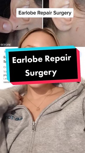 Earlobe Repair Surgery