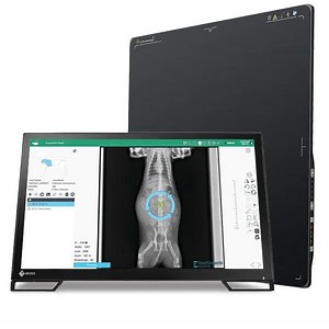 [Hot Item] Iray 17*17 Inch High Resolution Wireless X-ray Flat Panel Detector