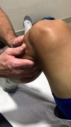 MANIPULATION OF THE PROXIMAL TIBIO-FIBULAR JOINT SUPINE POSITION