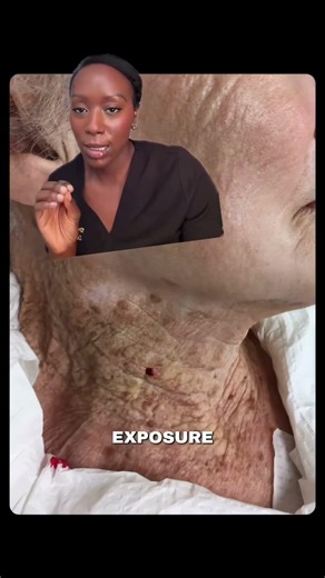 How To Apply Sunscreen!