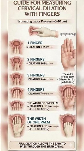 Cervical Dilation by Fingers: 1cm to 10cm Guide | How Midwives Check Labor Progress #mbbs #nursing