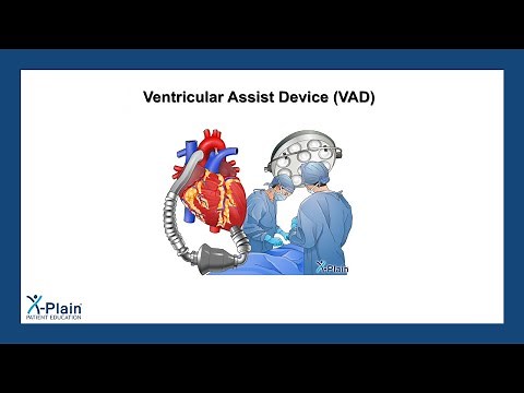 Ventricular Assist Device (VAD)