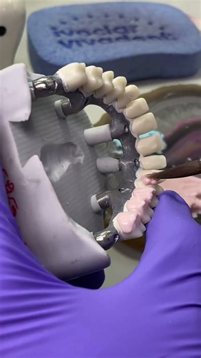 #dentalcaddesign #smiledesigndental #smile