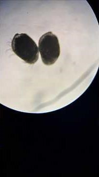 Ostracods in marine aquariums are generally beneficial and indicate a healthy system.