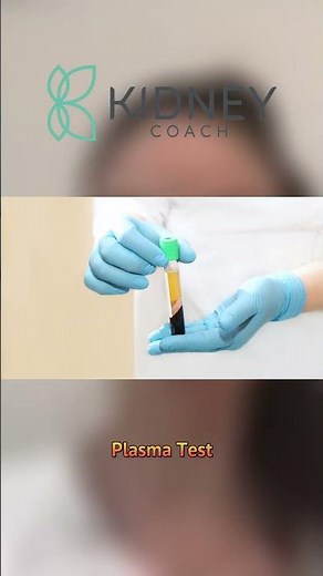 Taurine Testing: Insights into Assessing Taurine Levels