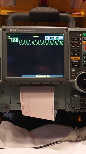 Say tuned for part 2 tomorrow 🚑 #ecg #ekg #paramedic | EKG