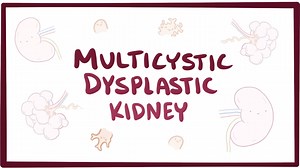 Multicystic dysplastic kidney: Video, Causes, & Meaning | Osmosis