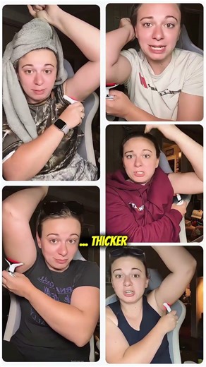 Get Rid of Flabby Arms & Loose Skin? My 90-Day Results with MyoGlow - My Derma Dream #flabbyarms