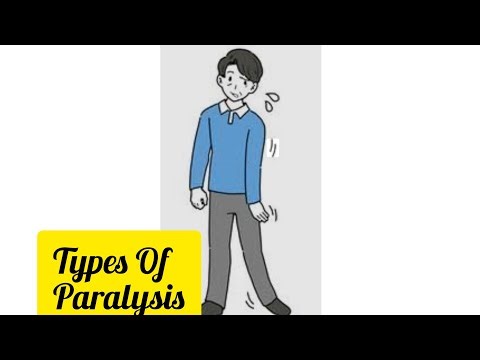 Types Of Paralysis