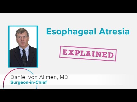 Esophageal Atresia: Explained | Cincinnati Children's