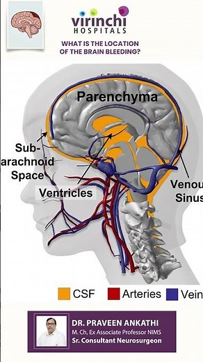What is the Location of a brain bleeding? 🧠 | Explained by Neurosurgeon | #virinchihospitals