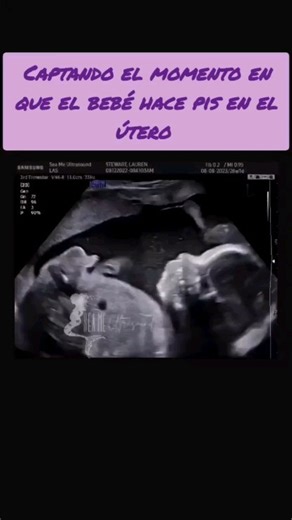 109K views · 1K reactions | HACIENDO PIS !!!! ¿Sabías que el bebé...