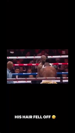 Red Rose Mobile Detailing on Instagram: "Bro this boxers hair FAILED HIM MID FIGHT! His toupee!"