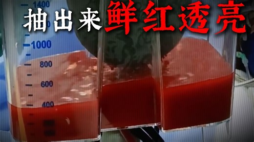 胖人和瘦人的血液有什么区别？？？