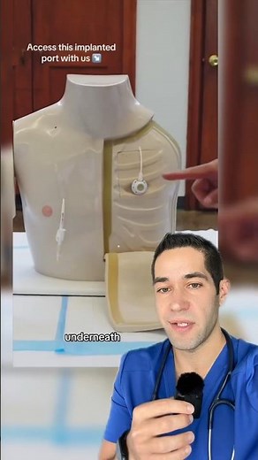 How a port is implanted