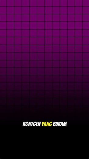 ‎عائشه هنا فريدا‎ on Instagram: "Mau tau cara deteksi tepi dan hasilnya ngga bakal penuh noise dan berantakan? Gunakan Highpass Filtering sebagai solusi cerdas untuk menyaring frekuensi rendah dan meloloskan frekuensi tinggi agar detail gambar jadi super tajam 🚀. Melalui Operator Sobel, kita bisa mereduksi noise berkat bobot c=2 di tengah kernel, sementara Operator Prewitt memberikan hasil tegas dengan prinsip fungsi Laplacian, dan Operator Laplacian bekerja paling presisi mencari posisi tepi