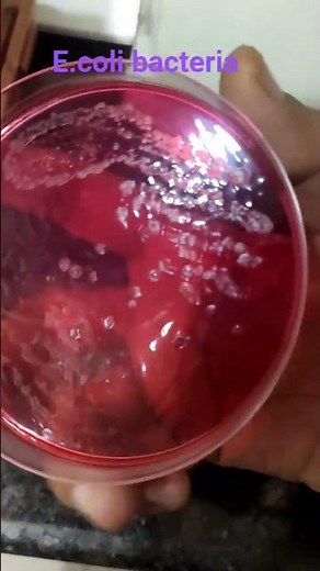 E.coli bacteria growth in pus culture #labtechnician #culture #labtest #lab