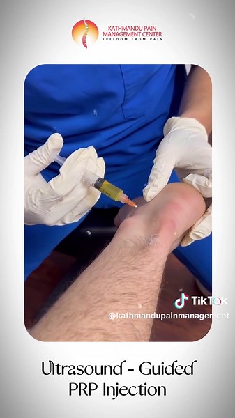 कुर्कुच्चा माथि खुट्टाको पछाडि दुखाइ : AChilles tendinopathy: Kathmandu pain management center : 014959863, 9803633480