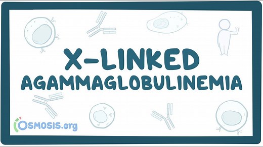 X-linked agammaglobulinemia: Video, Causes, & Meaning | Osmosis