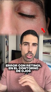 2.1K views · 3.2K reactions | ¡MUCHO CUIDADO con este ERROR CON EL...