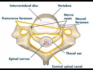 Anatomy and Applied anatomy of the Thecal Sac or Spinal Theca or Dural Sac