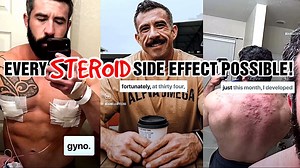 He had every steroid side effect possible