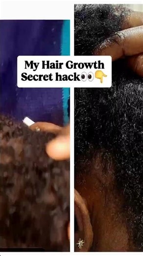 Real hair growth magic #beautyhacks
