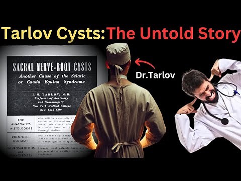 The Untold Story of Dr. Isadore Tarlov: Symptomatic Tarlov Cysts