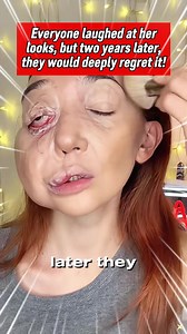Everyone laughed at her appearance, but two years later, they deeply regretted it!#us #truestory | NewYork-VR