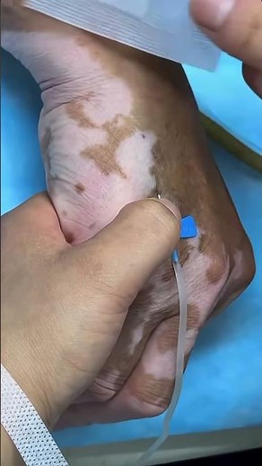 Intramuscular Injection Technique Explained |Safe IM Injection Step-by-Step |Nurse GuideClass 27