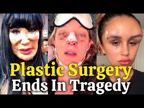 The Dark Side of Plastic Surgery: Beauty Procedures Gone Wrong