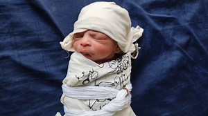 57K views · 2.3K reactions | Newborn baby after breech delivery birth with Flexible legs #newborn #baby #cute #girl | Love Sovannara | Facebook