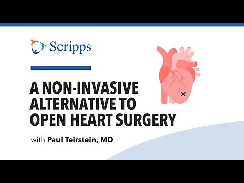 How to Fix Heart Valves With the TAVR Procedure | San Diego Health