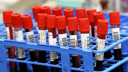 Genome study of 10,000 Black Canadians underway