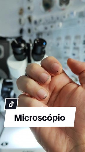 Sujeira da Unha no Microscópio: Descubra o que Há