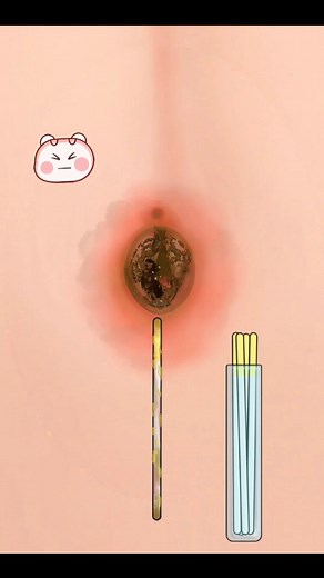 Don't get piercing if you can't clean your belly button! 🤢 #belly #button #cleaning #satisfying #asmr #mobilegame #fyp | ASMR Playzone