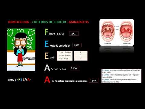CRITERIOS DE CENTOR - AMIGDALITIS - NEMOTECNIA
