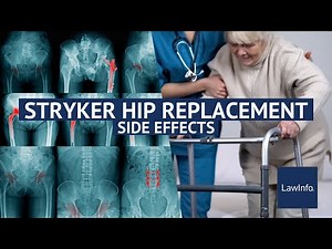 Stryker Hip Replacement Side Effects | LawInfo