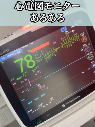 心電図モニターアラーム音と看護師の特別な感覚：急性期看護のリアル