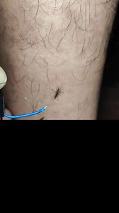 188K views · 644 reactions | DIY Mosquito Netting: Protect Your Home with These Easy Steps! ️ . . . . . . . #HomeDIY #MosquitoNet #StayProtected #mosquito #mosquitoes #mosquitobites #mosquitorepellent #mosquitokiller #mosquitos #mosquitocontrol #culicidae | Lexus Pet Boutique | Facebook