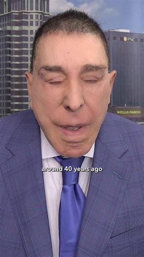 The Bonati Spine Institute was indeed where minimally invasive spine surgery began. The Bonati Spine Procedures have been improved and perfected over the past 40 years, and today represent the most advanced spine surgery. #minimallyinvasivespinesurgery #bonatispineprocedures #bonatispineinstitute #avoidfusion | Bonati Spine Institute