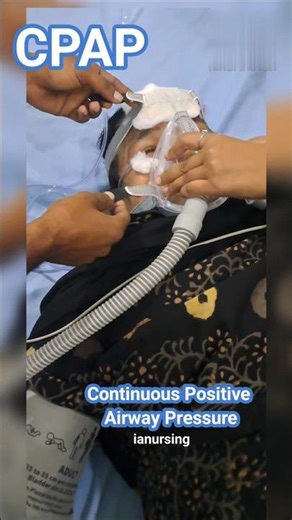 CPAP MACHINE #cpapmachine #trending