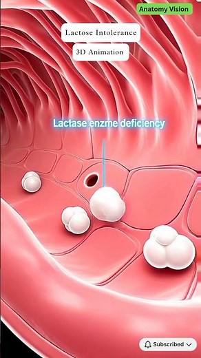 Lactose Intolerance Explained in 3D | What Happens When Milk Sugar Isn’t Digested? #anatomy