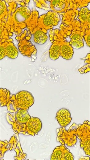 Botryococcus braunii – Mikroalg kolonileri