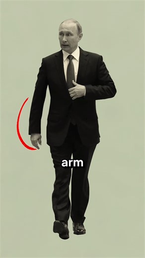 Putin’s Strange Walk Explained — Not Parkinson’s. 😱