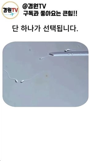 이건 실제 인공수정 장면 입니다!!!