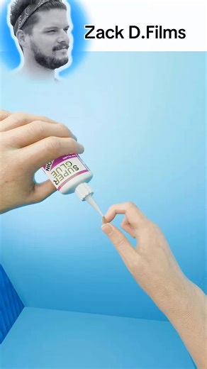 Superglue Teeth Hack: What You Need to Know