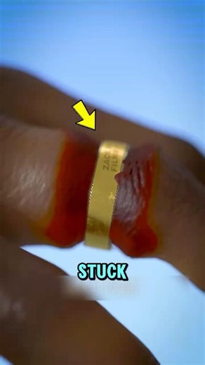 Ring Stuck on Your Finger Try This Simple Trick!